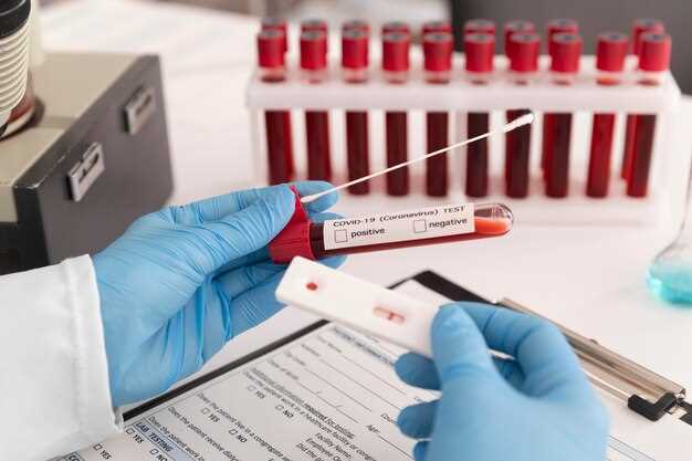Как правильно подготовиться к сдаче анализа крови на CDT?