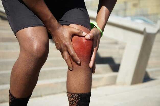 Время заживления связок коленного сустава в зависимости от повреждения