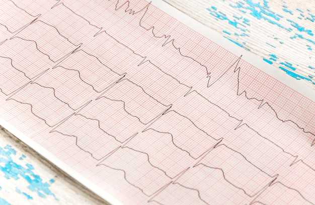 Частота сердечных сокращений и ее нормы