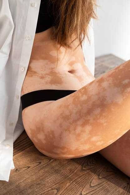 Как узнать, что пятно на теле является признаком опасной болезни