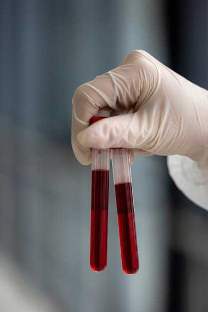 Какие лаборатории занимаются анализом кала на скрытую кровь