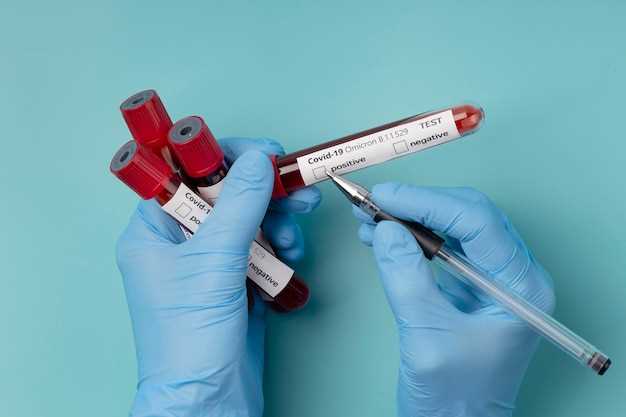 Какие заболевания могут быть обнаружены общим анализом крови?