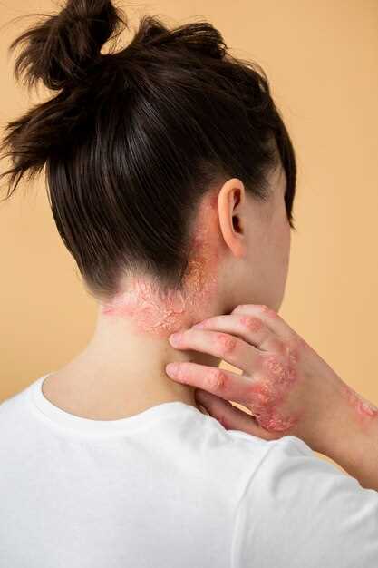 Что такое дерматит на коже и как его определить