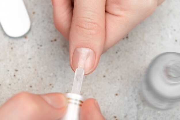 Белые пятна на ногтях: что они значат и как с ними бороться?