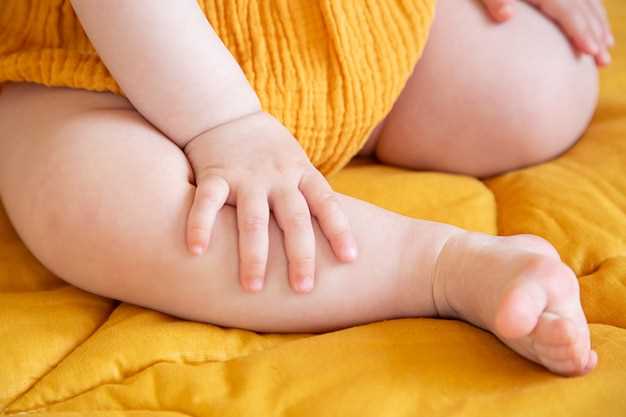 Сухая кожа и экзема на пальцах ног у ребенка