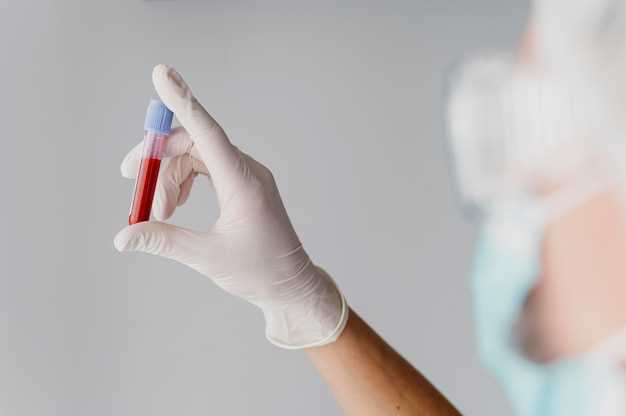 Сывороточное железо анализ крови: как правильно сдавать и оценивать результаты
