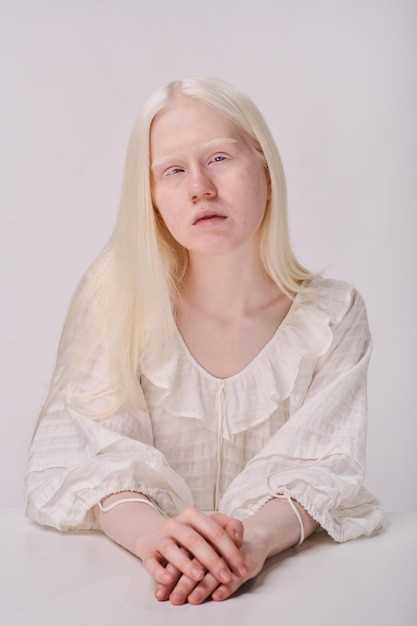 Влияние погодных условий на срок жизни альбиносов